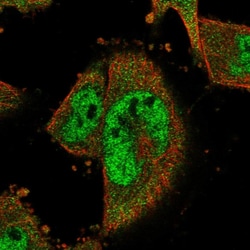 Invitrogen COPS8 Polyclonal Antibody 100 &mu;L; Unconjugated:Antibodies,