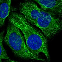 Invitrogen TBCA Polyclonal Antibody 100 &mu;L; Unconjugated:Anticorps,