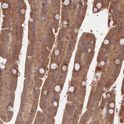 Invitrogen TBCA Polyclonal Antibody 100 &mu;L; Unconjugated:Anticorps,