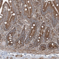 KY Polyclonal Antibody:Antibodies, Polyclonal