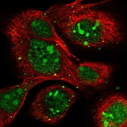Invitrogen NOP16 Polyclonal Antibody 100 &mu;L; Unconjugated:Antibodies,