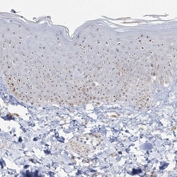 Invitrogen NOP16 Polyclonal Antibody 100 &mu;L; Unconjugated:Antibodies,