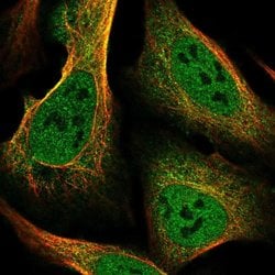 ZIP10 Polyclonal Antibody:Antibodies, Polyclonal