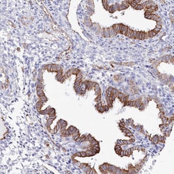 ZIP10 Polyclonal Antibody:Antibodies, Polyclonal