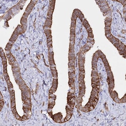 ZIP10 Polyclonal Antibody:Antibodies, Polyclonal
