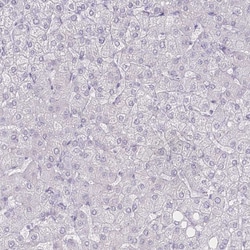 Invitrogen ZIP10 Polyclonal Antibody 100 &mu;L | Buy Online | Invitrogen&trade; | Fisher Scientific