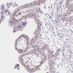 Invitrogen ZIP10 Polyclonal Antibody 100 &mu;L | Buy Online | Invitrogen&trade; | Fisher Scientific