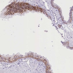 Invitrogen ZIP10 Polyclonal Antibody 100 &mu;L | Buy Online | Invitrogen&trade; | Fisher Scientific