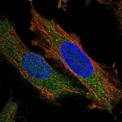 Invitrogen ZNF622 Polyclonal Antibody 100 &mu;L; Unconjugated:Antibodies,