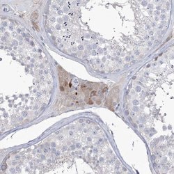 Invitrogen ZNF622 Polyclonal Antibody 100 &mu;L; Unconjugated:Antibodies,