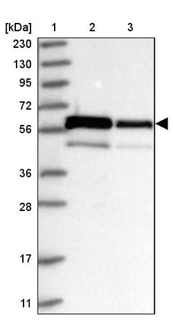 Invitrogen ZNF622 Polyclonal Antibody 100 &mu;L | Buy Online | Invitrogen&trade; | Fisher Scientific