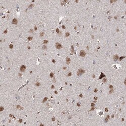 Invitrogen FAM13B Polyclonal Antibody 100 &mu;L; Unconjugated:Antibodies,