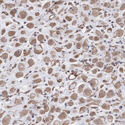 Invitrogen FAM13B Polyclonal Antibody 100 &mu;L; Unconjugated:Antibodies,