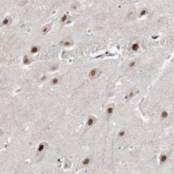 Invitrogen WAC Polyclonal Antibody 100 μL; Unconjugated:Antibodies,