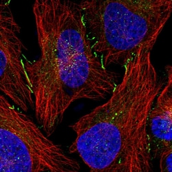 Invitrogen DJC18 Polyclonal Antibody 100 &mu;L; Unconjugated:Antibodies,