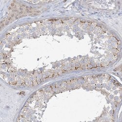 Invitrogen DJC18 Polyclonal Antibody 100 &mu;L; Unconjugated:Antibodies,