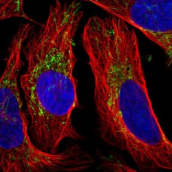 Invitrogen HIBCH Polyclonal Antibody 100 &mu;L; Unconjugated:Antibodies,