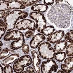 Invitrogen HIBCH Polyclonal Antibody 100 &mu;L; Unconjugated:Antibodies,