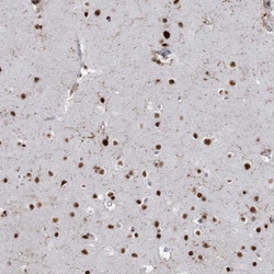 Invitrogen DDX46 Polyclonal Antibody 100 &mu;L; Unconjugated:Antibodies,