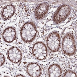 Invitrogen DDX46 Polyclonal Antibody 100 &mu;L; Unconjugated:Antibodies,