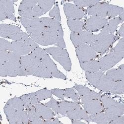 Invitrogen DDX46 Polyclonal Antibody 100 &mu;L; Unconjugated:Antibodies,
