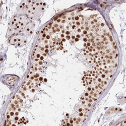 Invitrogen DDX46 Polyclonal Antibody 100 &mu;L; Unconjugated:Antibodies,