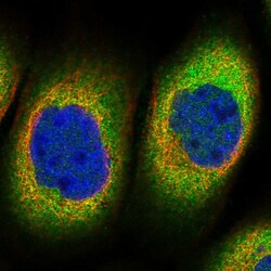 Invitrogen TTC1 Polyclonal Antibody 100 &mu;L; Unconjugated:Antibodies,