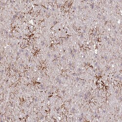 Invitrogen TTC1 Polyclonal Antibody 100 &mu;L; Unconjugated:Antibodies,