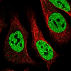 MATR3 Polyclonal Antibody:Antibodies, Polyclonal