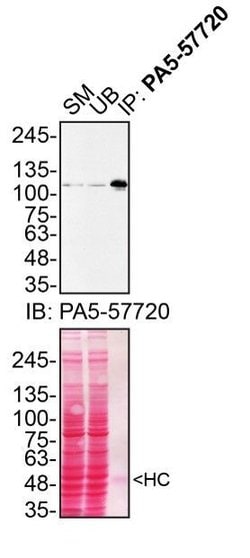 MATR3 Polyclonal Antibody:Antibodies, Polyclonal