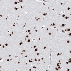 MATR3 Polyclonal Antibody:Antibodies, Polyclonal