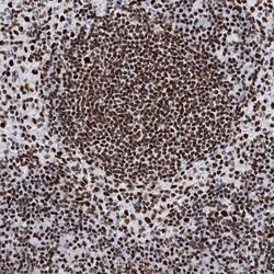 MATR3 Polyclonal Antibody:Antibodies, Polyclonal