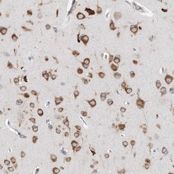 Invitrogen LAR4B Polyclonal Antibody 100 &mu;L; Unconjugated:Antibodies,