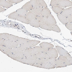Invitrogen LAR4B Polyclonal Antibody 100 &mu;L; Unconjugated:Antibodies,