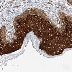 Invitrogen LAR4B Polyclonal Antibody 100 &mu;L; Unconjugated:Antibodies,