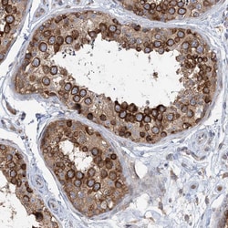 Invitrogen LAR4B Polyclonal Antibody 100 &mu;L; Unconjugated:Antibodies,