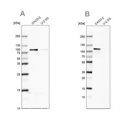 Invitrogen LAR4B Polyclonal Antibody 100 &mu;L; Unconjugated:Antibodies,