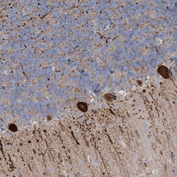 Invitrogen CMBL Polyclonal Antibody 100 &mu;L; Unconjugated:Antibodies,
