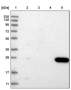 Invitrogen CMBL Polyclonal Antibody 100 &mu;L; Unconjugated:Antibodies,