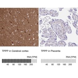 Invitrogen TPPP Polyclonal Antibody 100 &mu;L | Buy Online | Invitrogen&trade; | Fisher Scientific