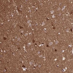 Invitrogen TPPP Polyclonal Antibody 100 &mu;L | Buy Online | Invitrogen&trade; | Fisher Scientific