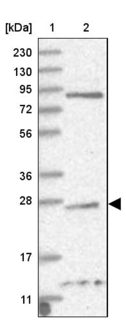Invitrogen TPPP Polyclonal Antibody 100 &mu;L | Buy Online | Invitrogen&trade; | Fisher Scientific