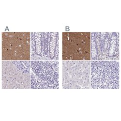 Invitrogen TPPP Polyclonal Antibody 100 &mu;L; Unconjugated:Antibodies,