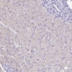 Invitrogen TPPP Polyclonal Antibody 100 &mu;L; Unconjugated:Antibodies,