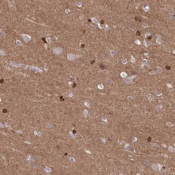 Invitrogen TPPP Polyclonal Antibody 100 &mu;L; Unconjugated:Antibodies,