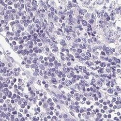 Invitrogen TPPP Polyclonal Antibody 100 &mu;L; Unconjugated:Antibodies,