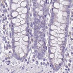 Invitrogen TPPP Polyclonal Antibody 100 &mu;L; Unconjugated:Antibodies,