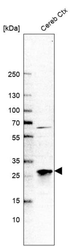 Invitrogen TPPP Polyclonal Antibody 100 &mu;L; Unconjugated:Antibodies,