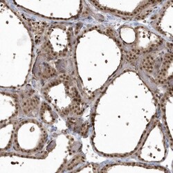 Invitrogen EPB41L4A Polyclonal Antibody 100 &mu;L; Unconjugated:Antibodies,