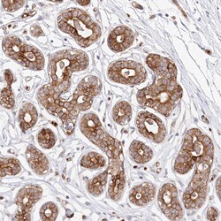 Invitrogen COMMD3 Polyclonal Antibody 100 &mu;L; Unconjugated:Antibodies,